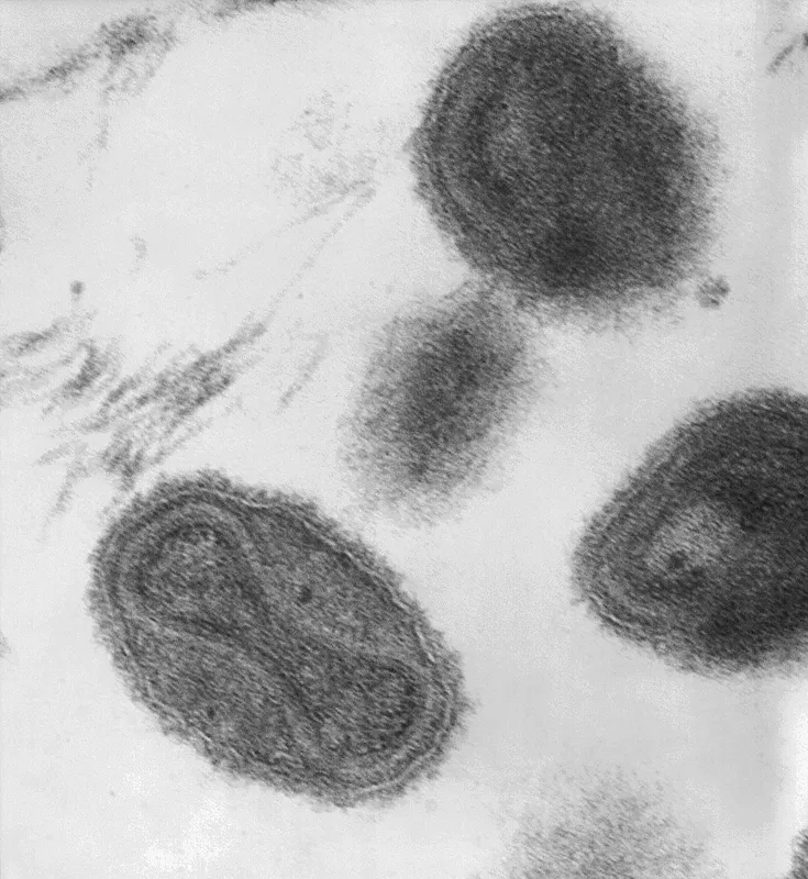 Plaga de VIRUELA, SARNA DE LA PATATA, RHIZOCTONIA SOLANI